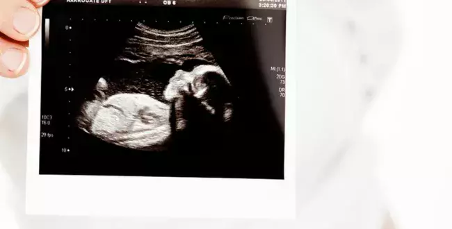 Bezpłatne badania prenatalne dla wszystkich kobiet w ciąży – niezależnie od wieku